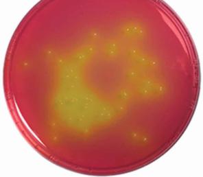 توزیع کننده کلنی میکروارگانیسم درجه یک