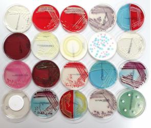 مرکز توزیع کلنی میکروارگانیسم عمده