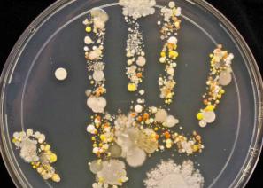 فروش مستقیم کلنی کانتر واکسن سازی