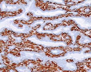 توزیع کننده لام ایمنوهیستوشیمی صادراتی