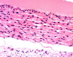 بازار فروش لام سیلانه پاتولوژی مرغوب