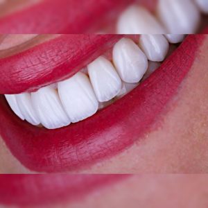 فروش کامپوزیت نانو سرامیک با کیفیت بالا + قیمت خرید به صرفه