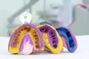 “خرید ست قالبگیری دندان پروتسیل  + بهترین قیمت”