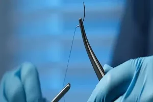 قیمت خرید پنس بخیه + فروش در تجارت و صادرات